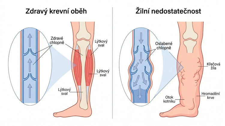 Mechanismus — žilní návrat a gravitace